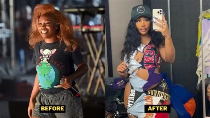Did Stunna Girl Get A BBL? Before And After Butt Augmentation!