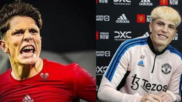 Garnacho Alejandro Did Fix His Teeth With Dental Surgery